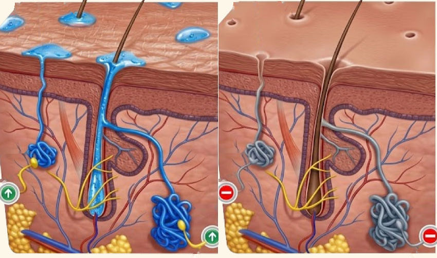 A drawing of the skin before Botox: the sweat glands active, beads of sweat at the pores