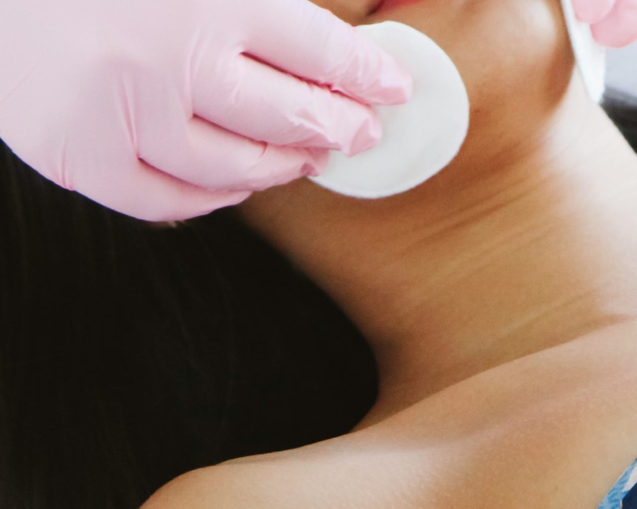 A pink-gloved hand prepares the skin along the jaw with a cotton pad before treatment.