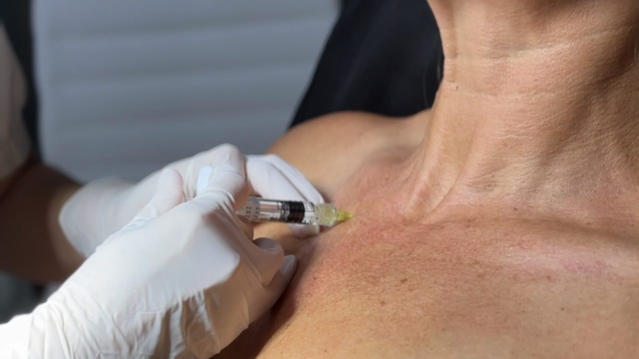 A Cocoon doctor placing Revok50 into the skin of the neck and décolletage