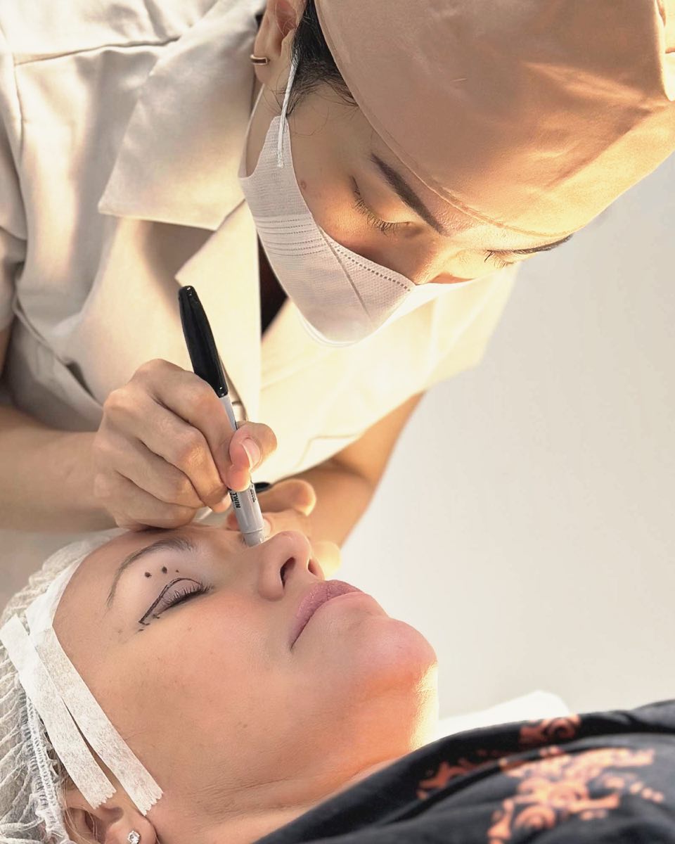 A surgeon marking the upper eyelid before blepharoplasty at Cocoon
