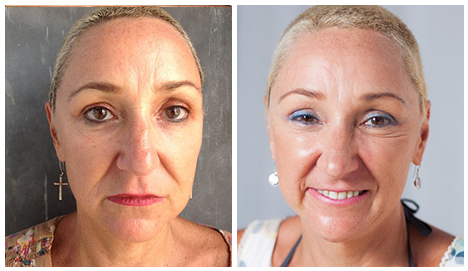 Before After - Naked Skin Package 1