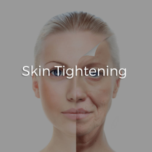 skin tightening
