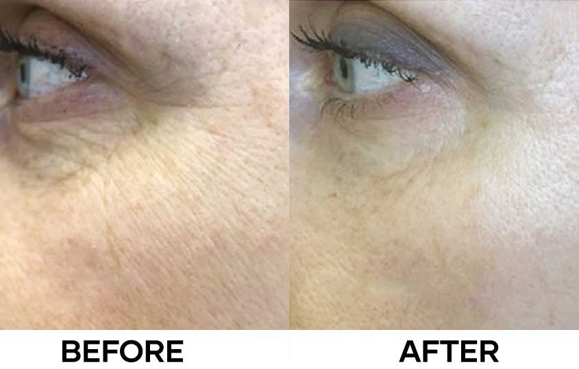 Before After Aquashine PTX