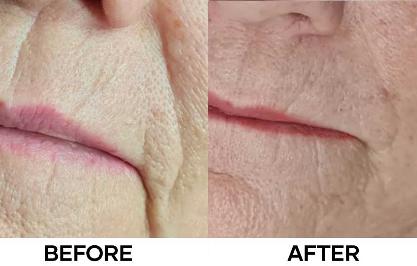 Before After Aquashine PTX