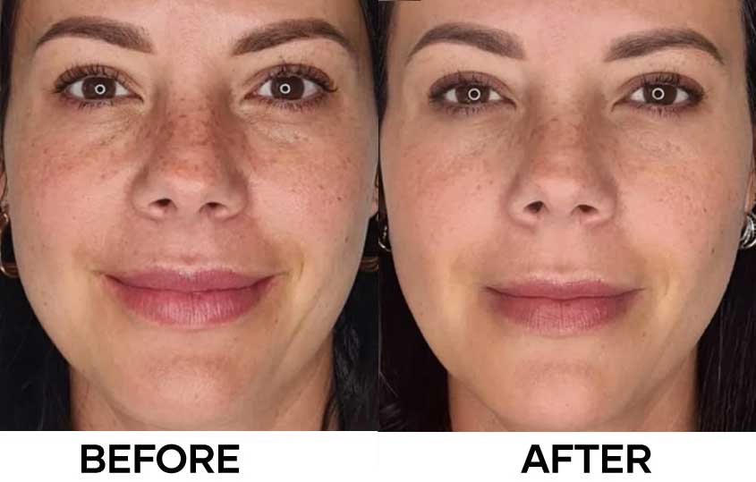 Before After Aquashine PTX