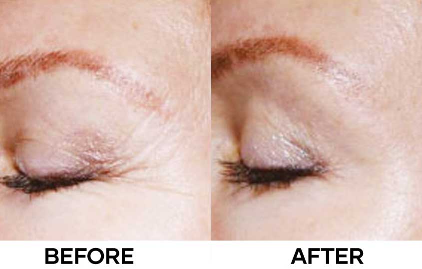 Before After Aquashine PTX