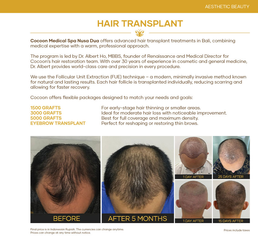 Hair Transplant