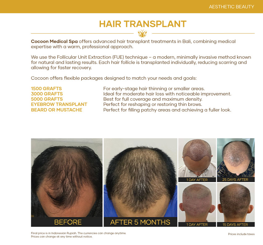 Hair Transplant