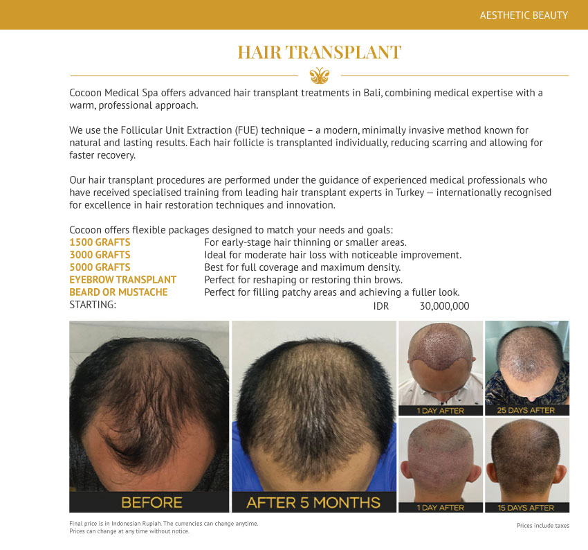 Hair Transplant