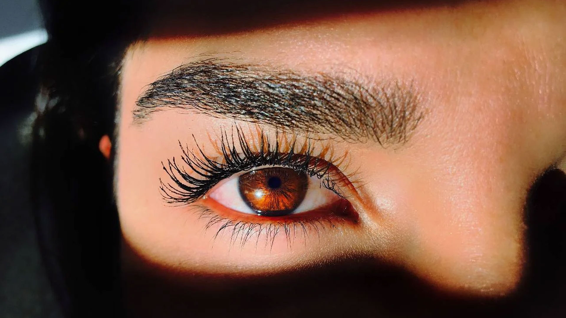Blepharoplasty